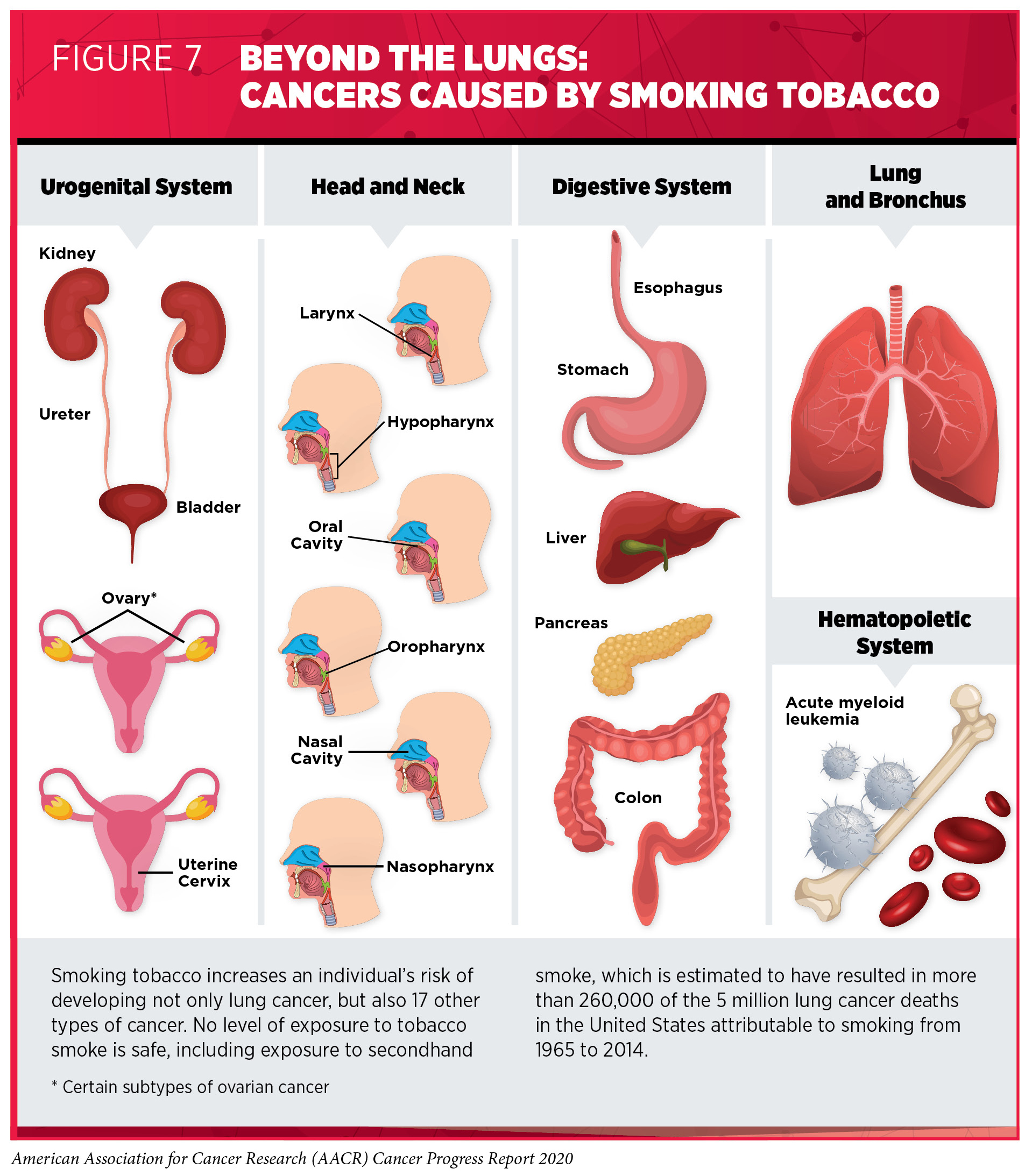 Smoking Causes Cancer