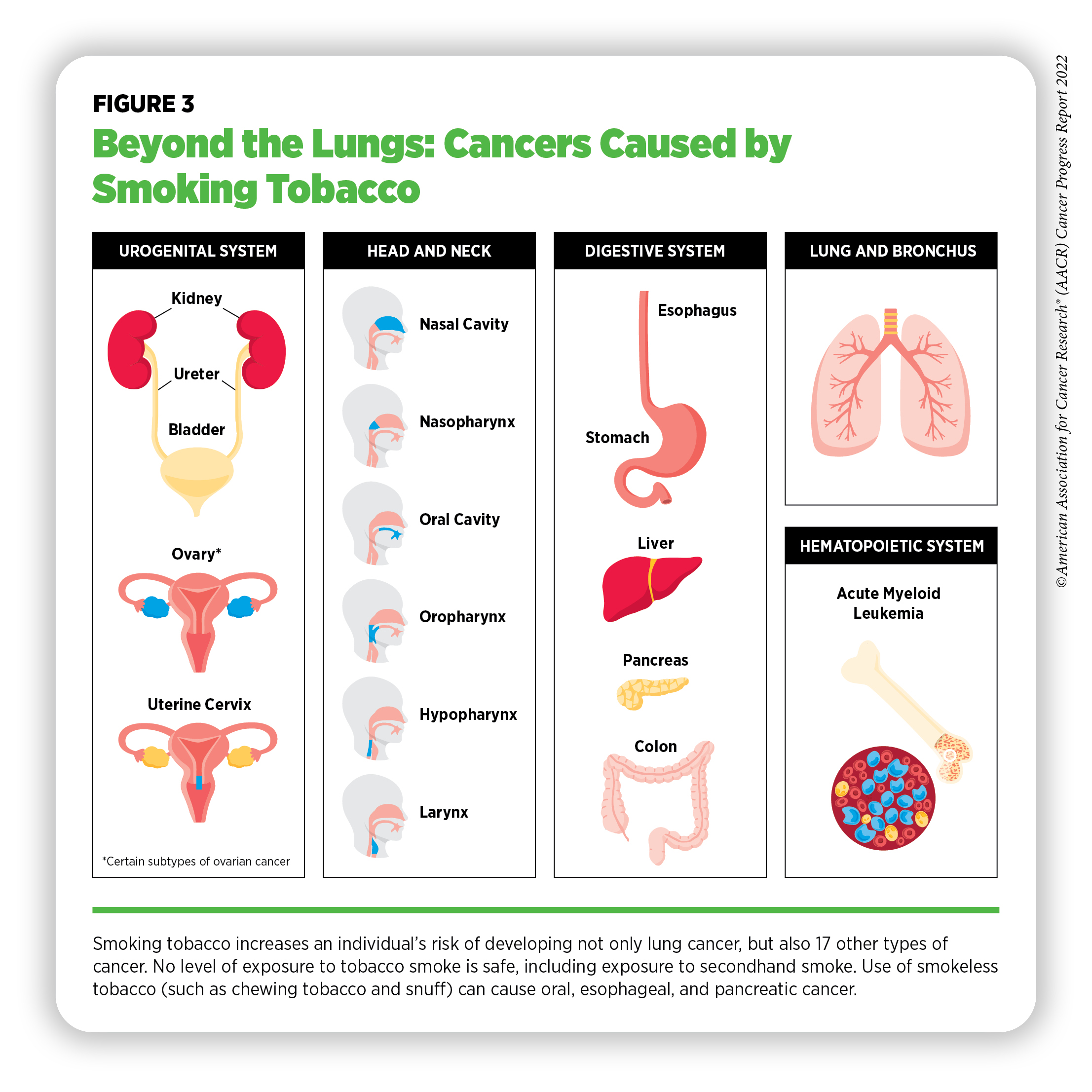 Preventing Cancer Risk Factors AACR Cancer Progress Report