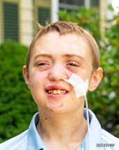 A Second Chance, Thanks to Research and Hope