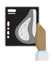 Disparities in Cancer Screening for Early Detection – CDPR26