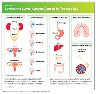 Figure 9: Smoking tobacco increases an individual’s risk of developing not only lung cancer but also 17 other types of cancer.